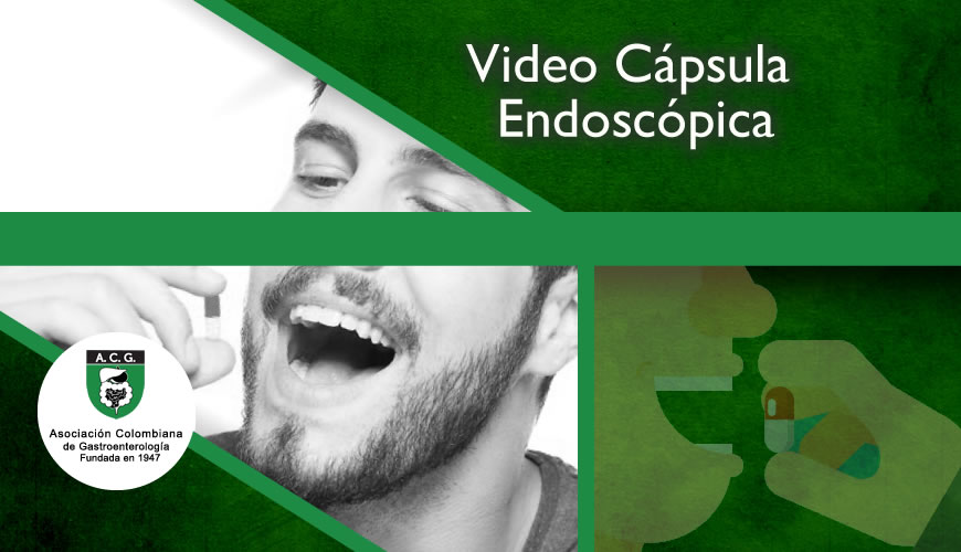 Video Cápsula Endoscópica
