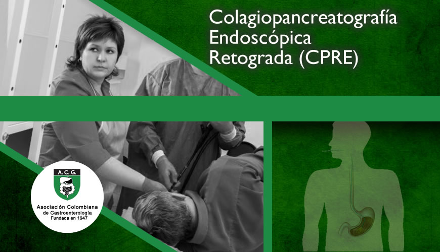 Colagiopancreatografía Endoscópica Retrograda (CPRE)