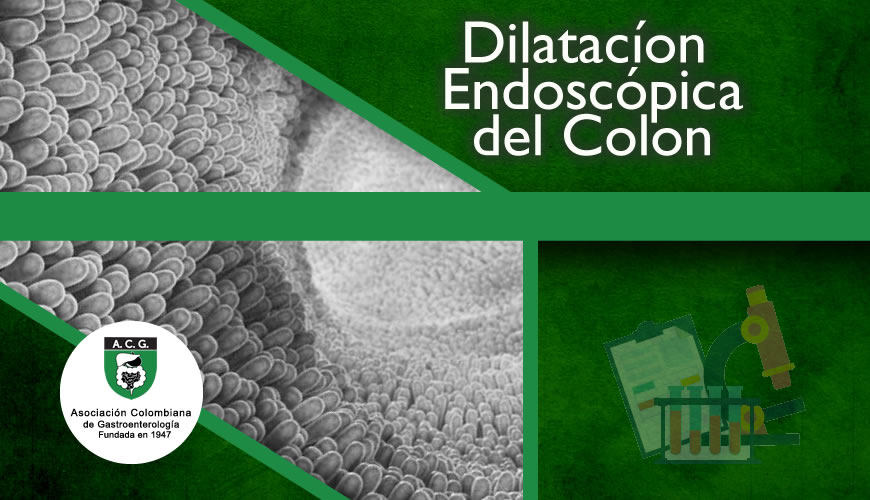 Dilatacíon Endoscópica del Colon
