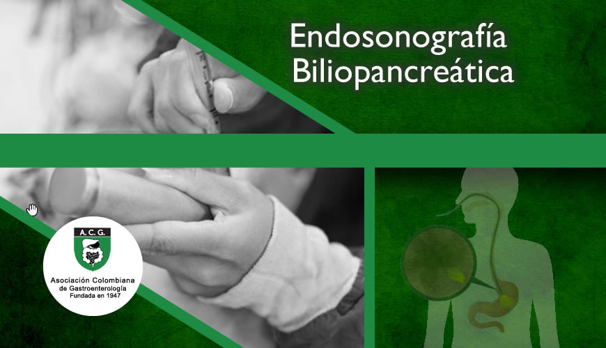 Endosonografía Biliopancreática